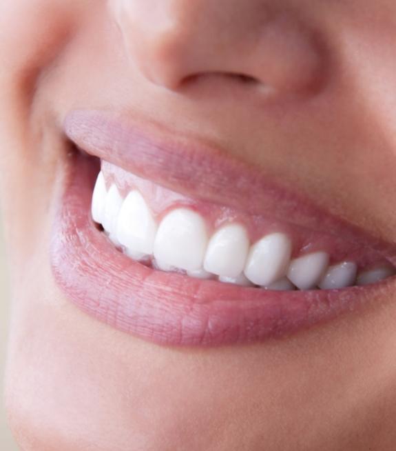 Close up of smile with flawlessly straight white teeth