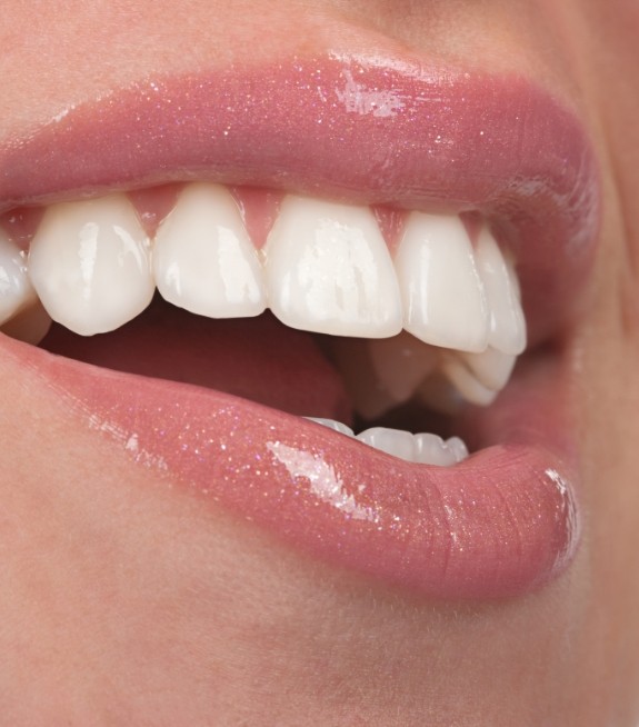 Close up of mouth with flawless white teeth